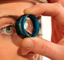 glaucoma- glaucoma-